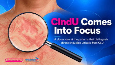 Chronic Inducible Urticaria