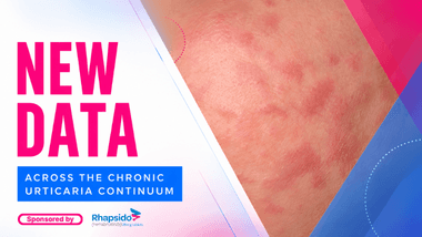 Chronic Urticaria Data