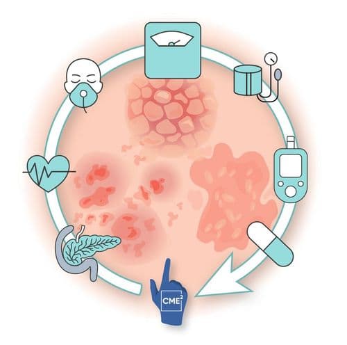GLP-1s in a Flash! Swiping Through Barriers in Psoriasis Care